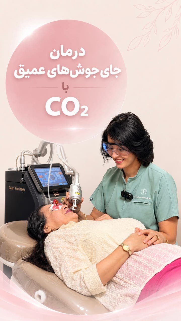 درمان جای جوش‌های عمیق با لیزر CO2
